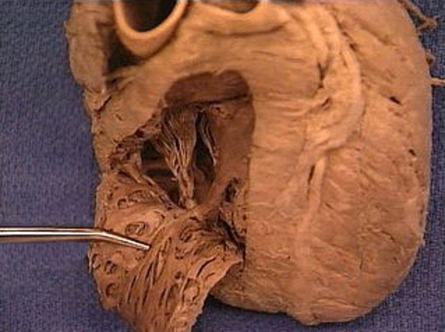 <p>Structure; in right ventricle</p><p>dirt of carrot</p><p>R/L</p><p>H8</p>