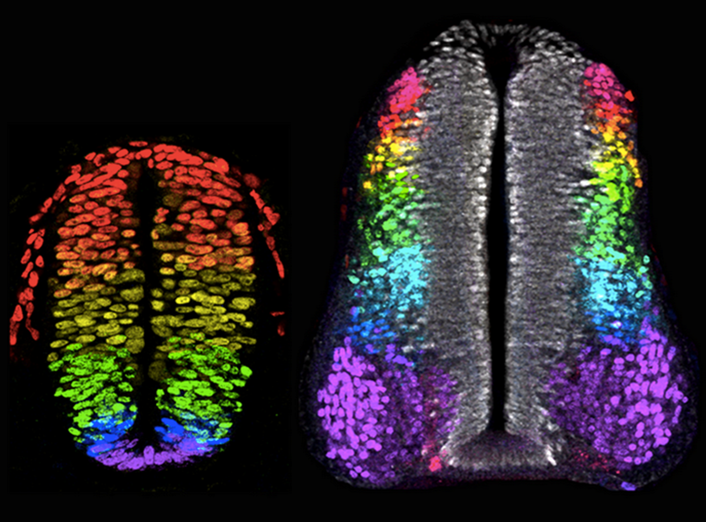 <p>How do different concentrations of Shh and different BMP family members lead to the specification of diverse neuronal subtypes along the D-V axis of the neural tube?</p>