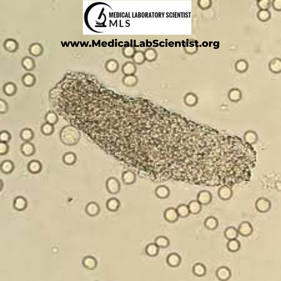 <p>What do you see in this image? What does it indicate?</p>