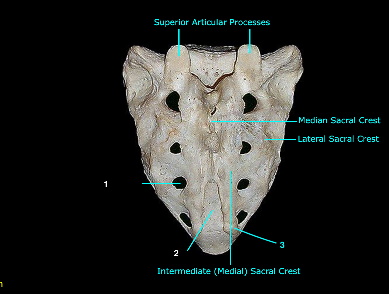 <p>What structure is labeled 1?</p>