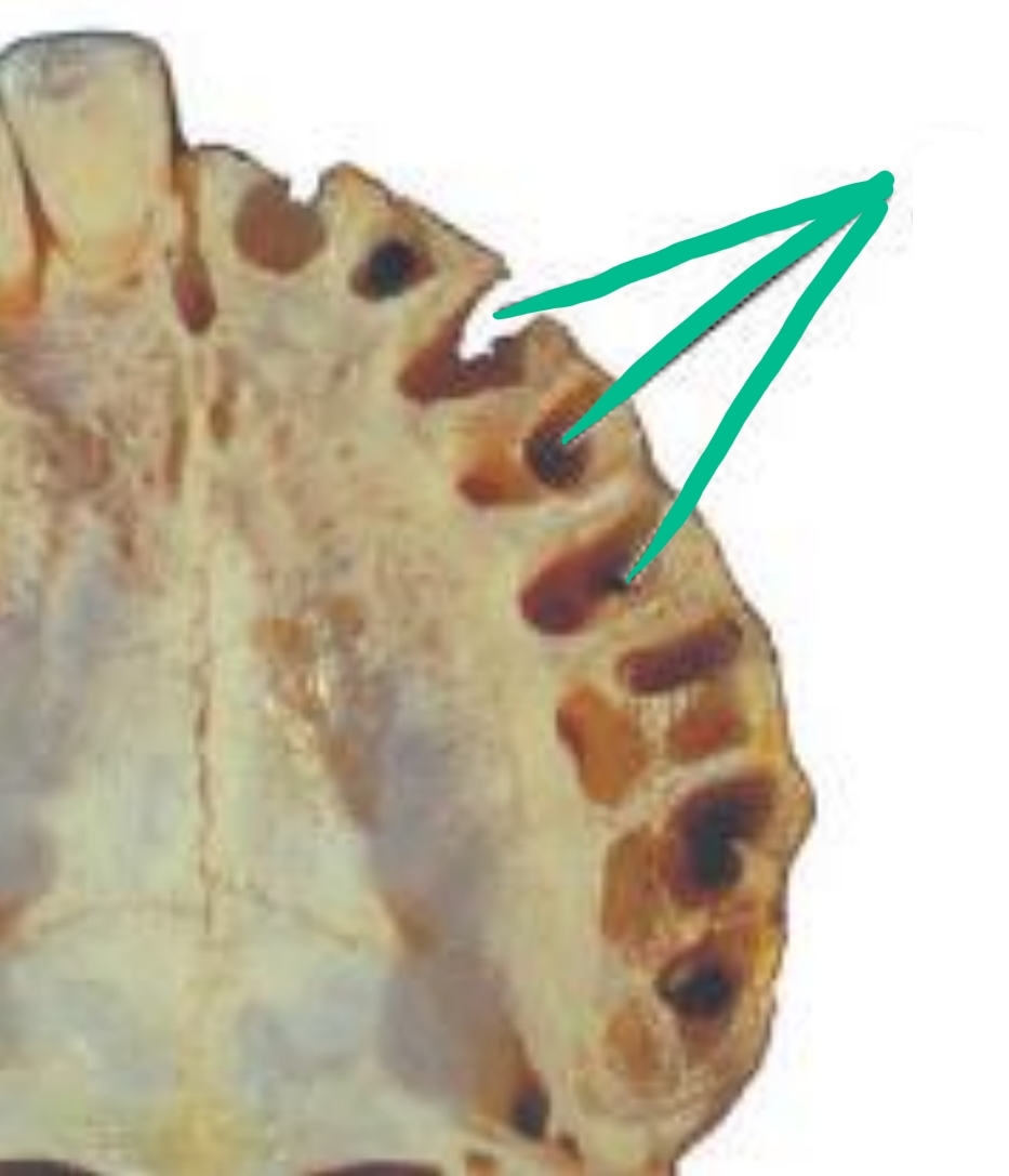 <p>Socket (hole) where tooth is missing; where roots were</p><p></p>