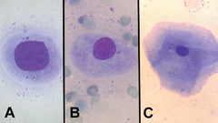 <p>Name these types of vaginal epithelial cells</p>