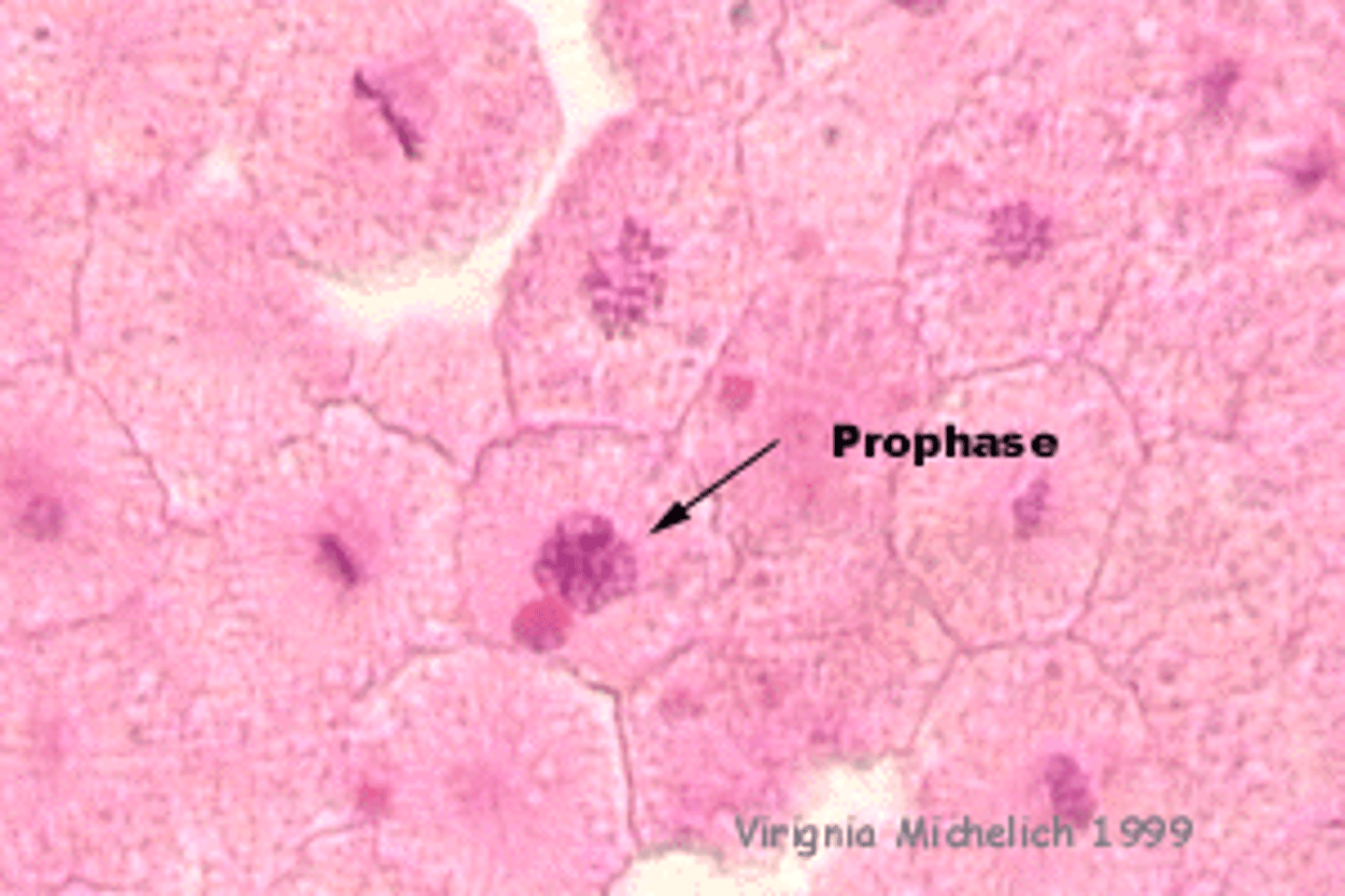 <p>chromatin starts to coil up</p>