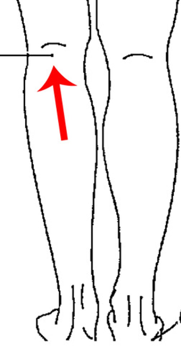 <p>The posterior region of the knee supported by extracapsular and intracapsular ligaments.</p>
