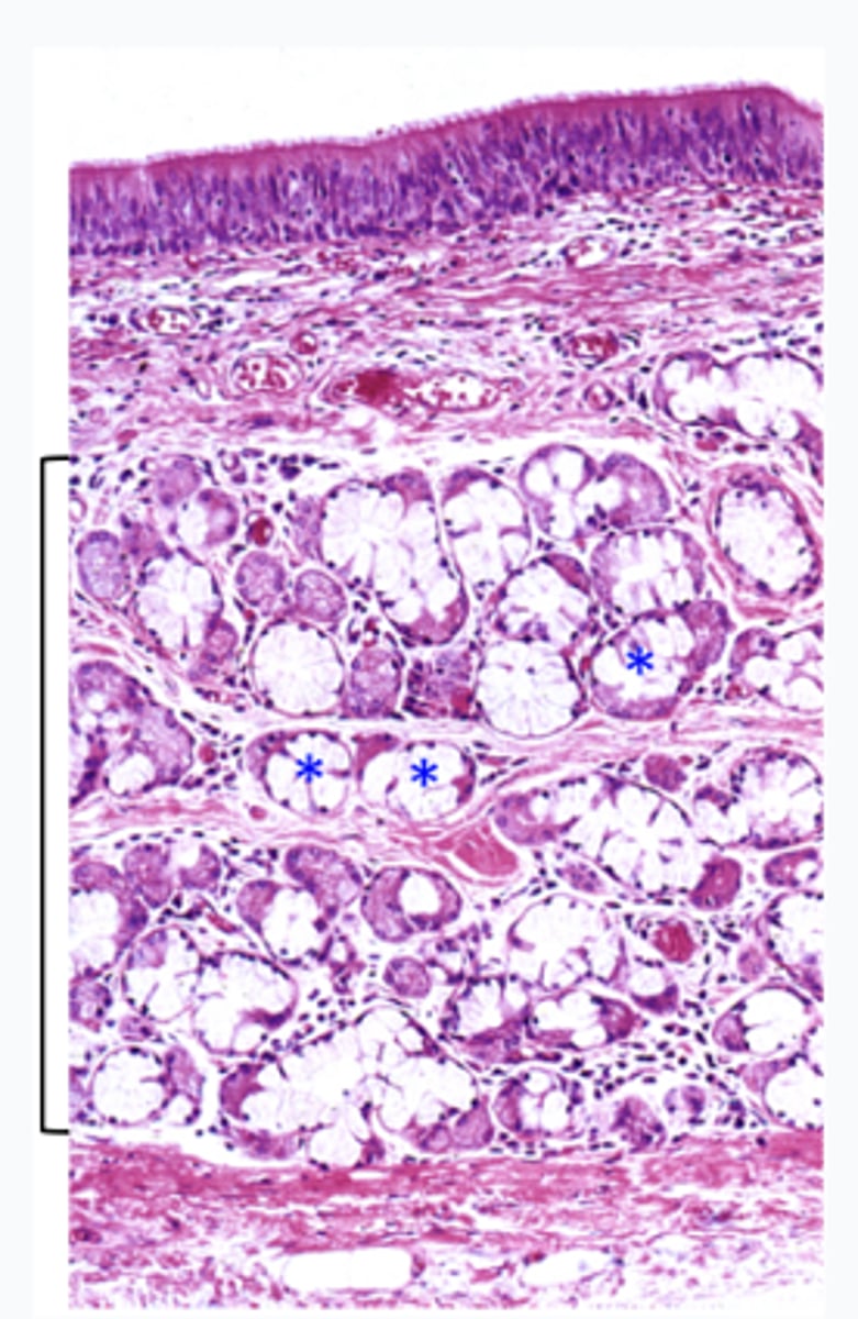 <p>This micrograph is representative of what structure?</p>