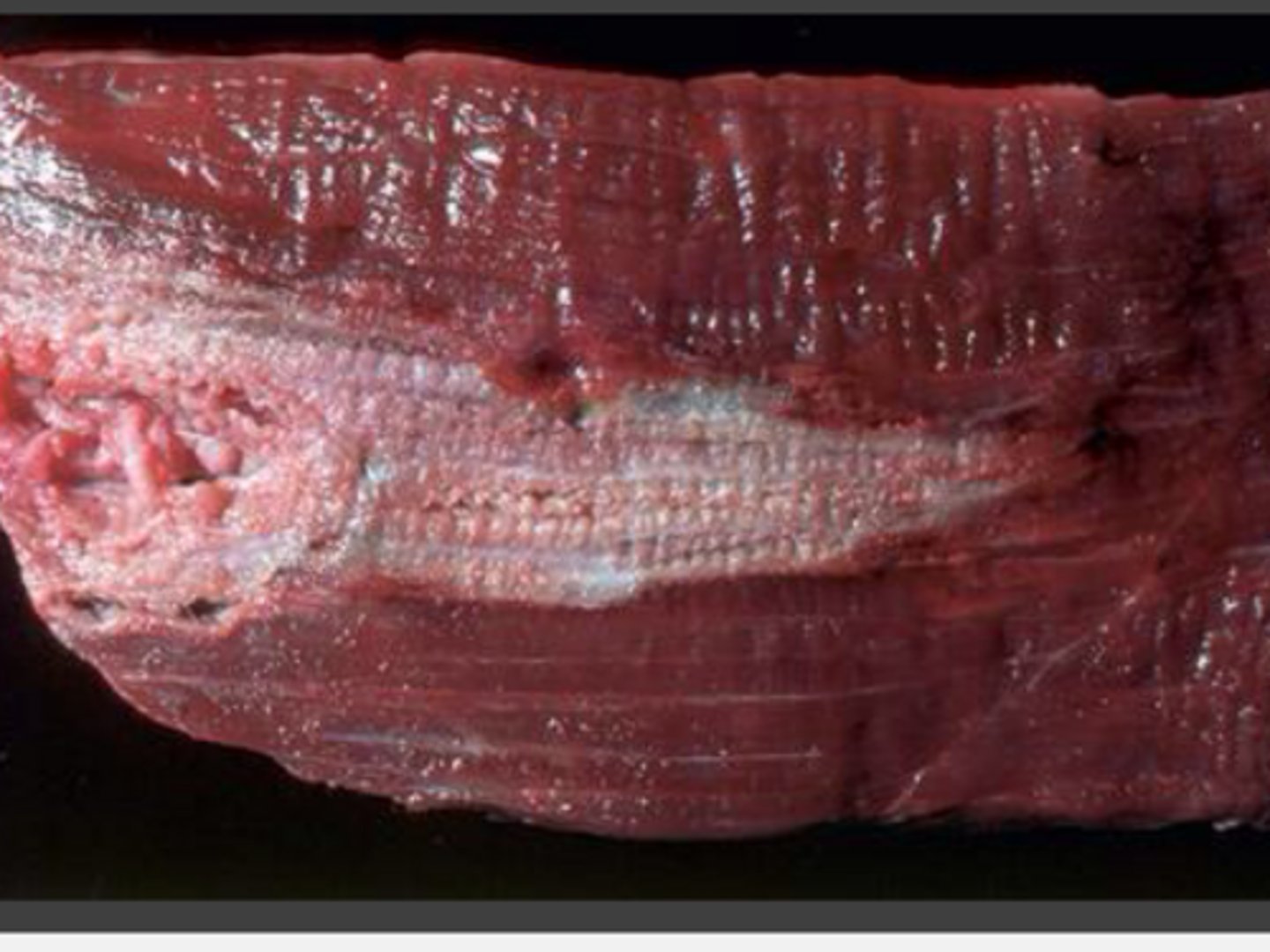 <p>What are causes of localized pallor?</p>