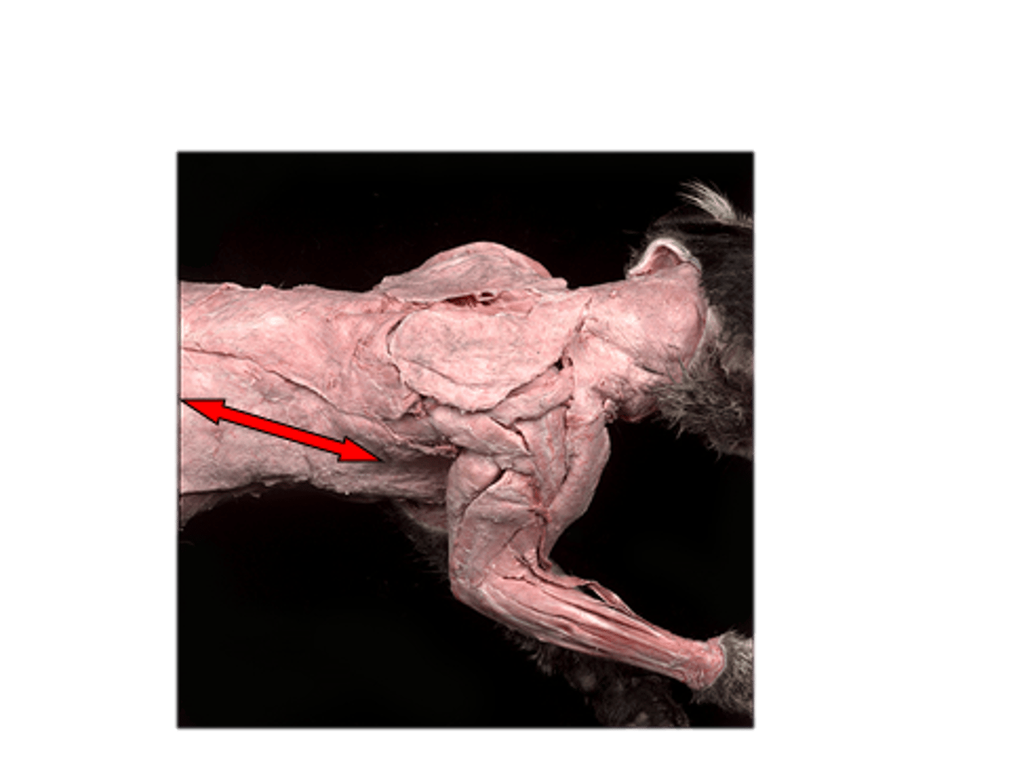 <p>Muscle is best seen from in a posterior view</p>