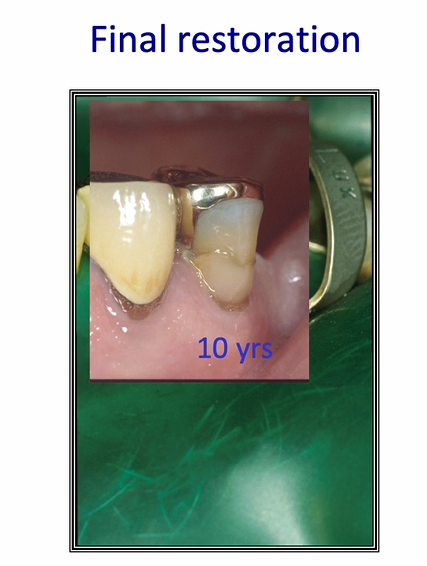 <p>final restoration after 10 years&nbsp;</p>