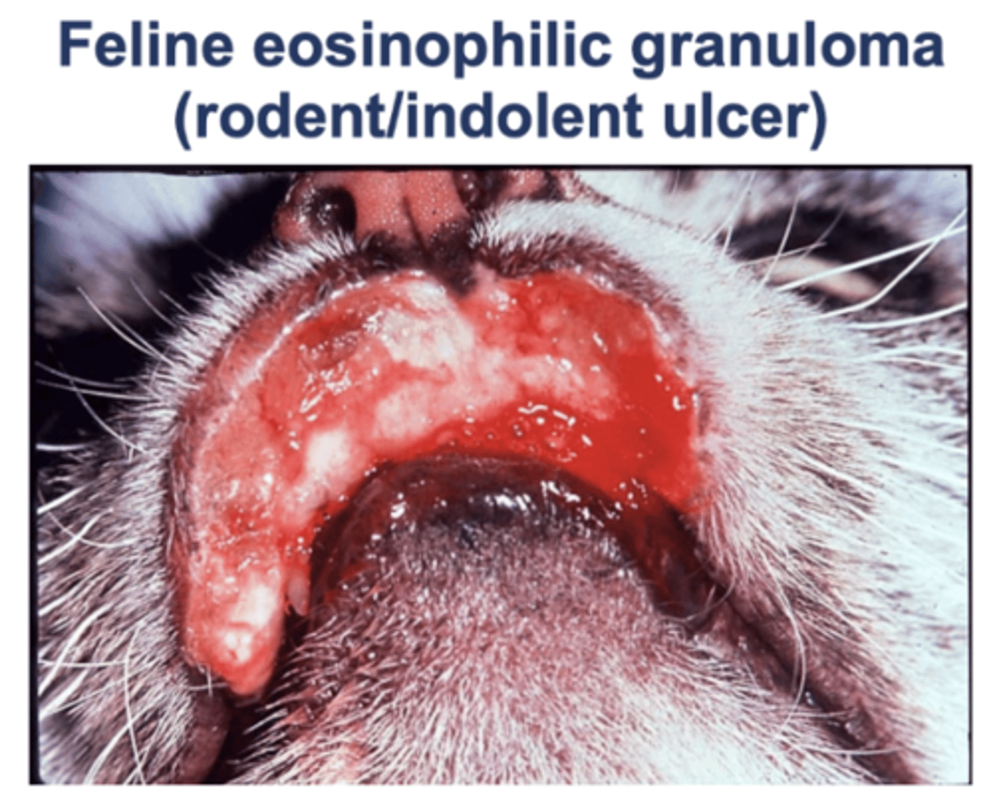 <p>- Thought to be hypersensitivity, but pathogenesis is still unclear</p>