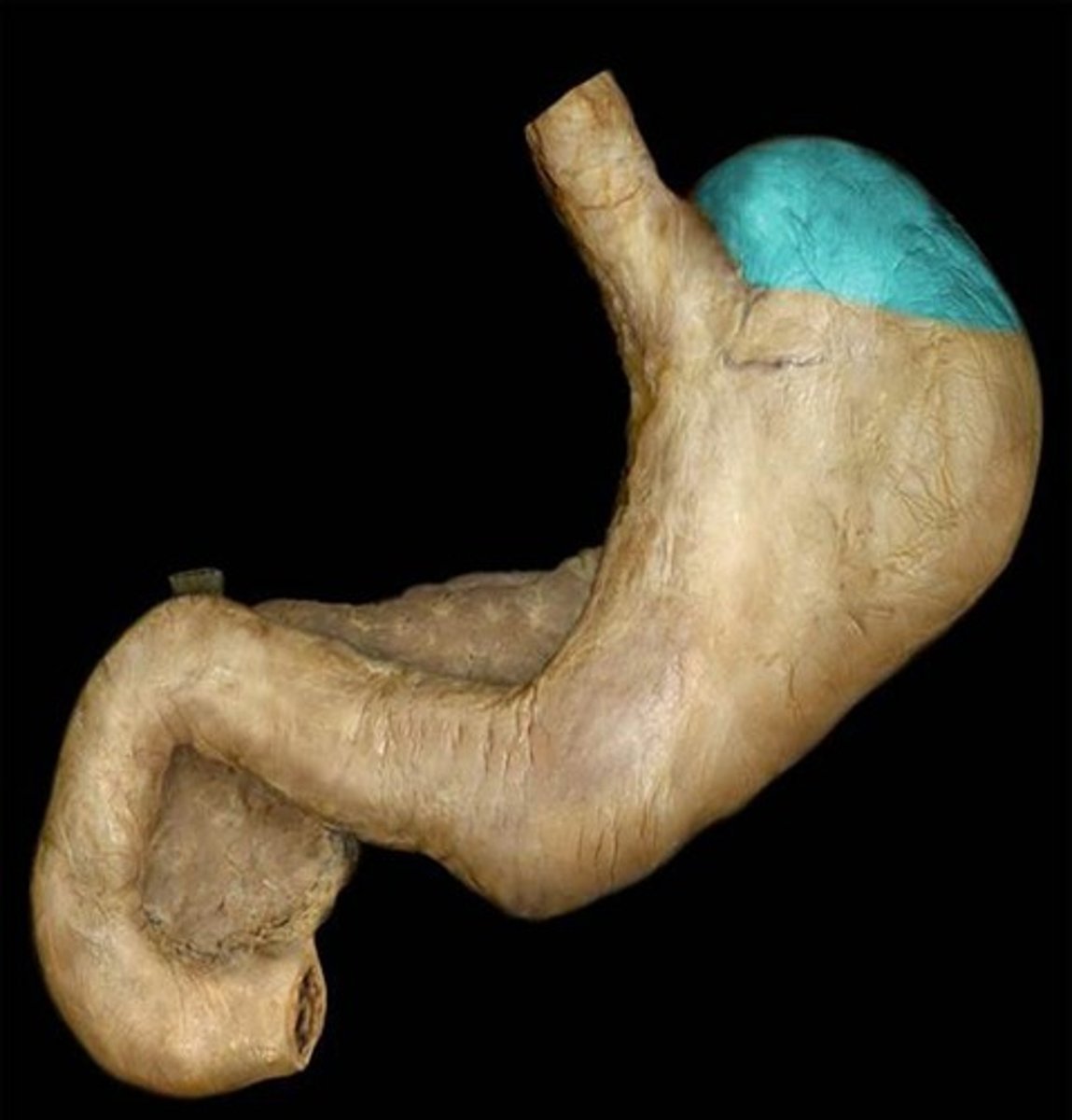 <p>Name this region of the stomach.</p>