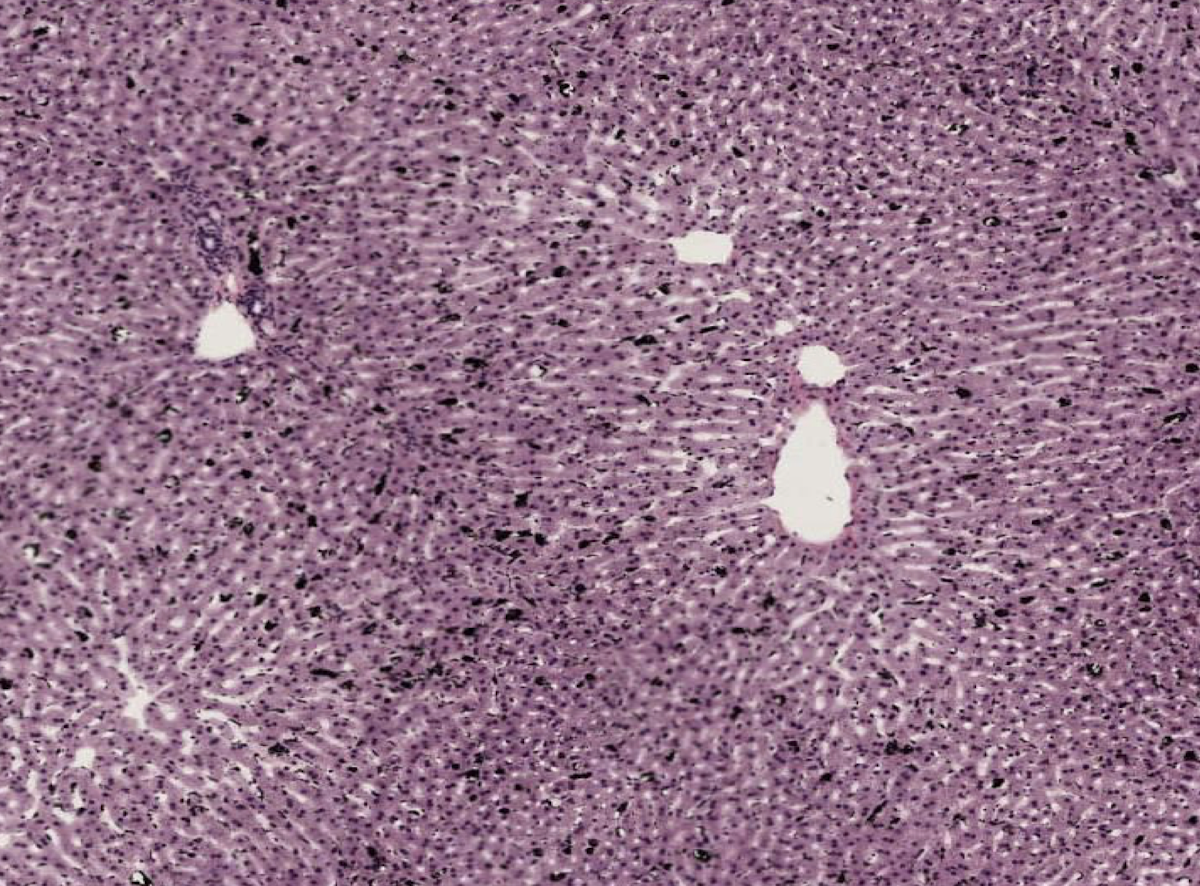 <p>What other cells (aside from hepatocytes) are found in sinusoids? Describe their function.</p>