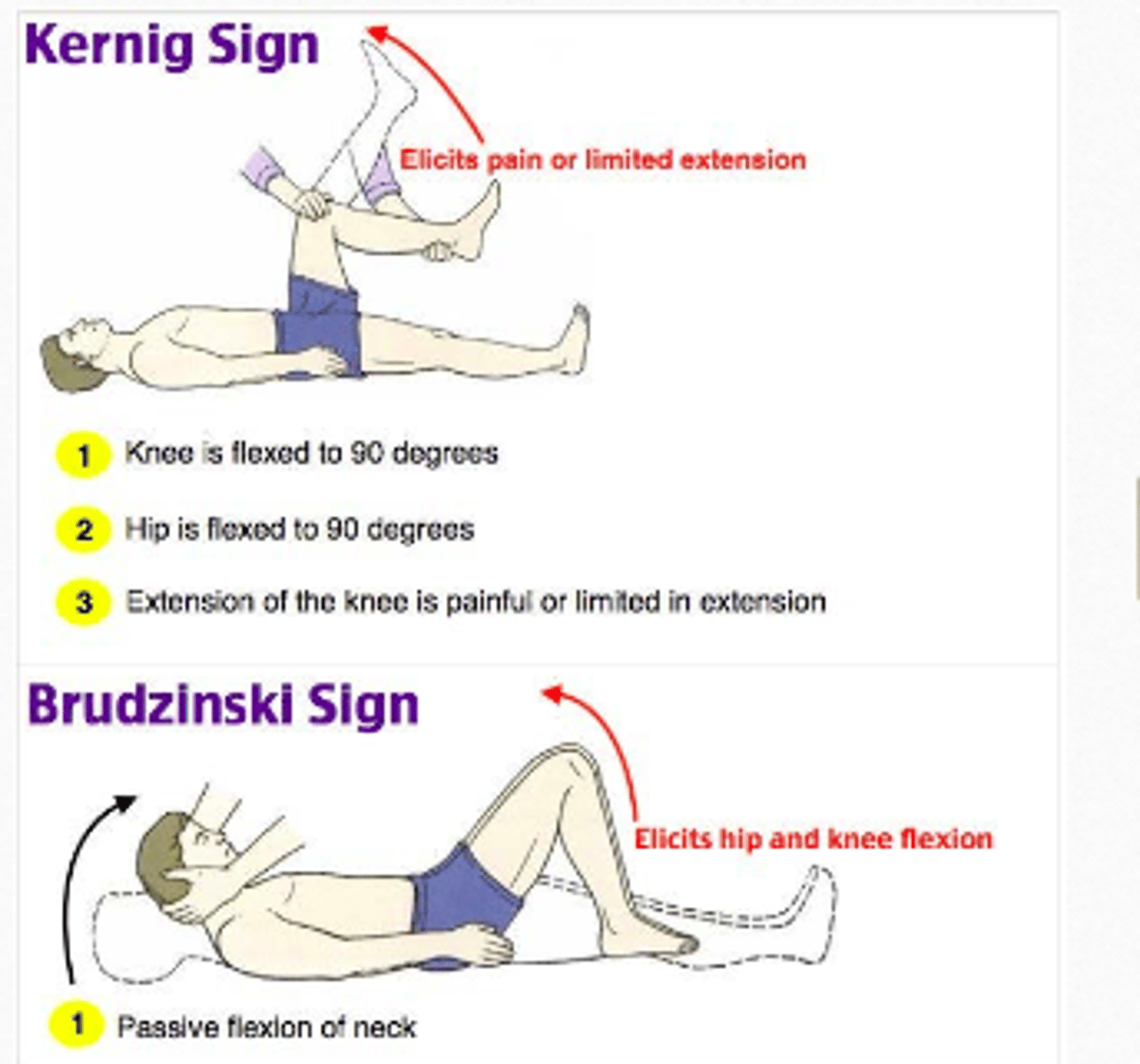 <p>Kernig's sign</p><p>Brudzinski sign</p>