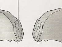 <p>point of articulation for pelvis and vertebrae </p>