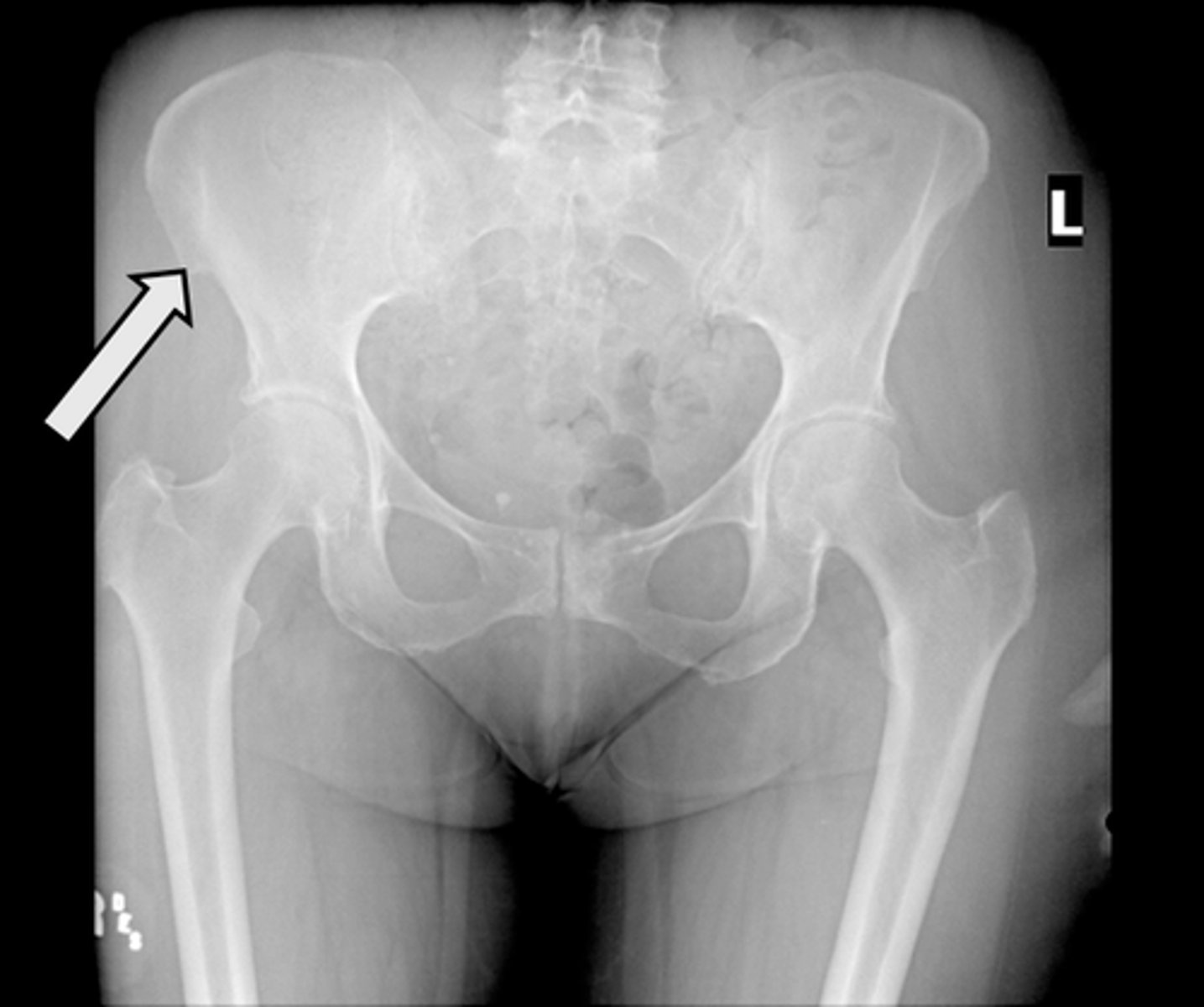 <p>What is indicated in the image?</p>