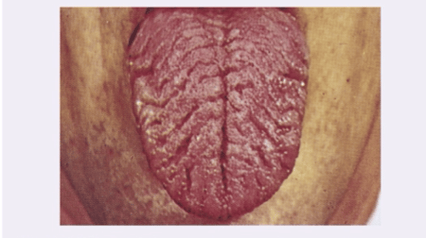 <p>Diagnosis?</p>