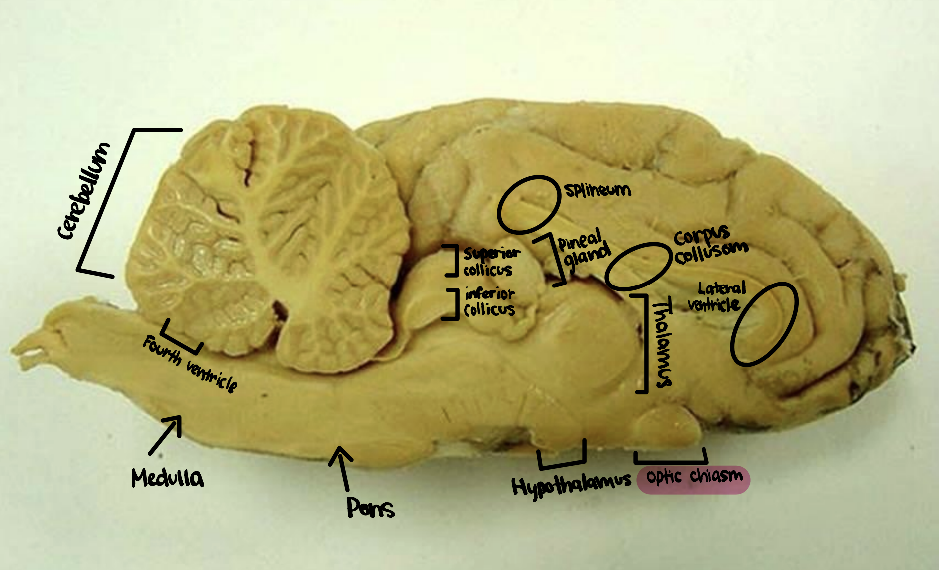 <p>Optic Chiasm</p>