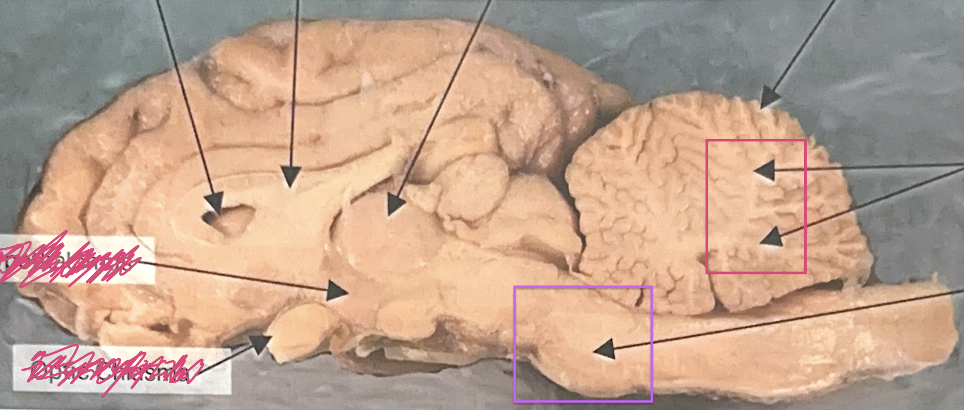 <p>What is this highlighted figure? (PURPLE)</p>