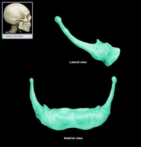 <p>floating bone found at junction of floor of mouth and neck</p>