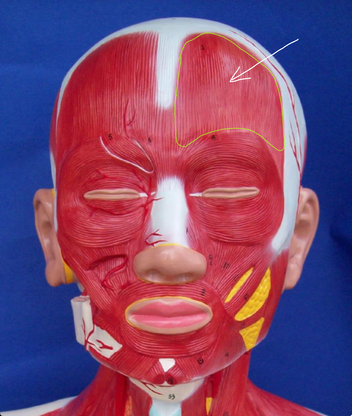 <p>What type of muscle is this</p><p></p>