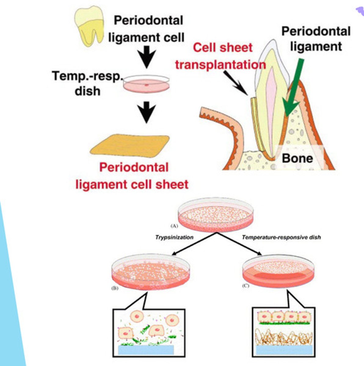 <p>PDLSCs grown on temp sensitive culture --&gt; detach from petri dish when temp changes --&gt; placed on periodontal ligament cell sheet --&gt; allow cells to be placed around the tooth &amp; implanted in layers</p>