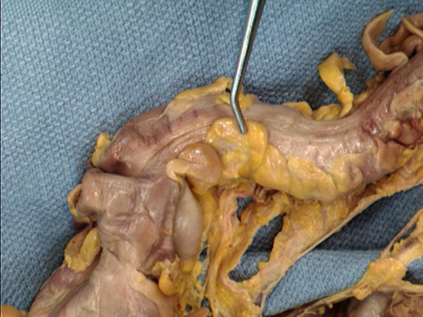 <p>What is this?</p>