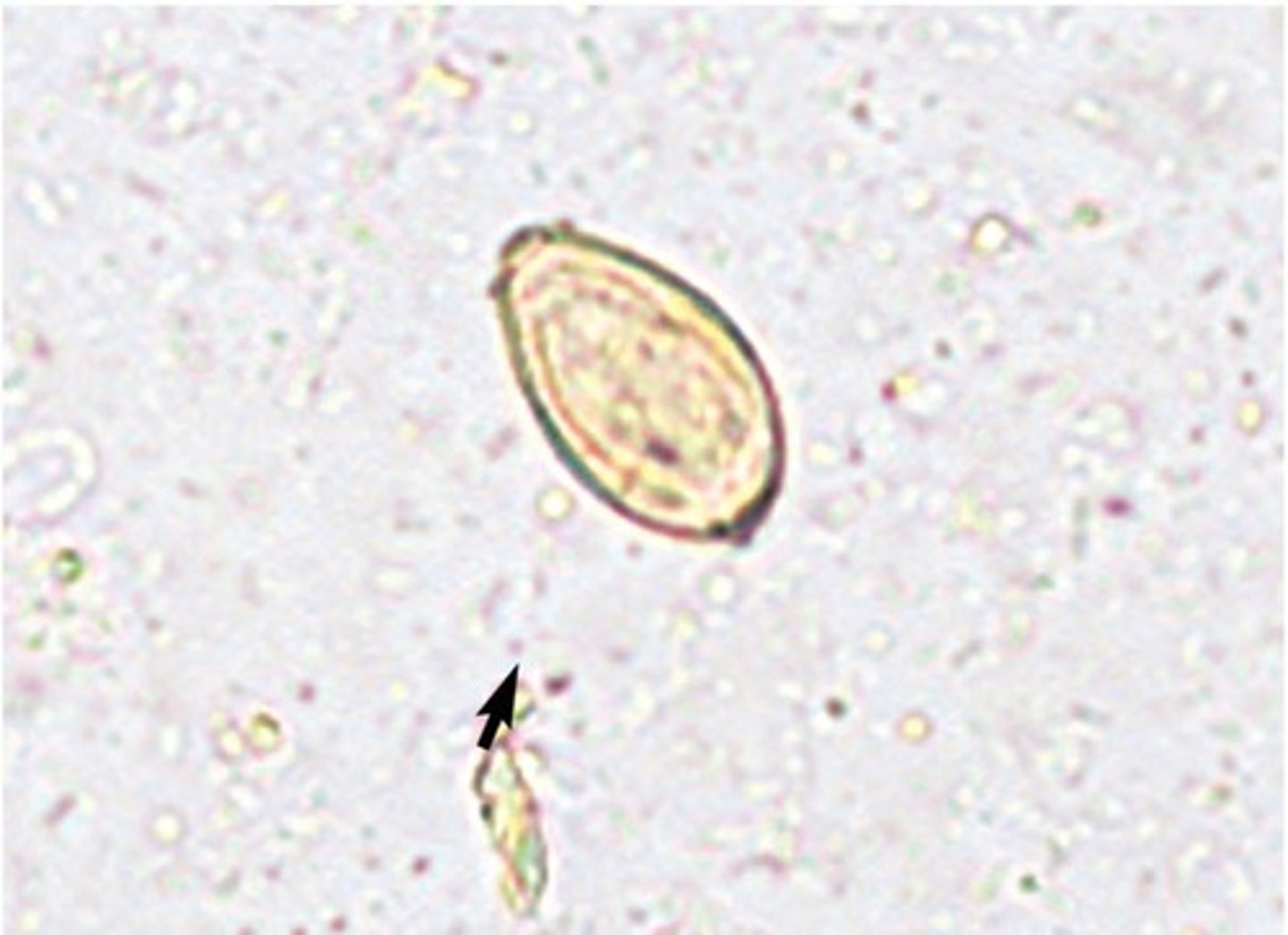 <p>The adult trematode lives in the liver and is found in China, Japan, Korea, and Vietnam. What ovum is present?</p>