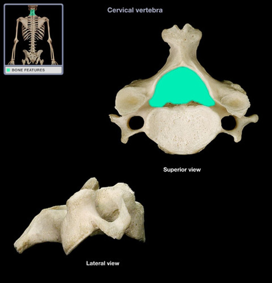 <p>(what type and what structure is highlighted)</p>