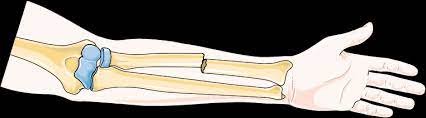 <p>It does not break the skin.</p>