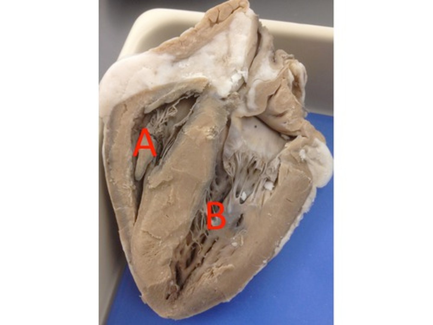 <p>What is the name for the chamber at B?</p>