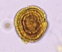 <p>What type of acid urine crystal is this?</p>