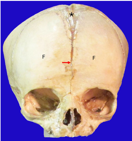 <p>What is represented by the arrow?</p>