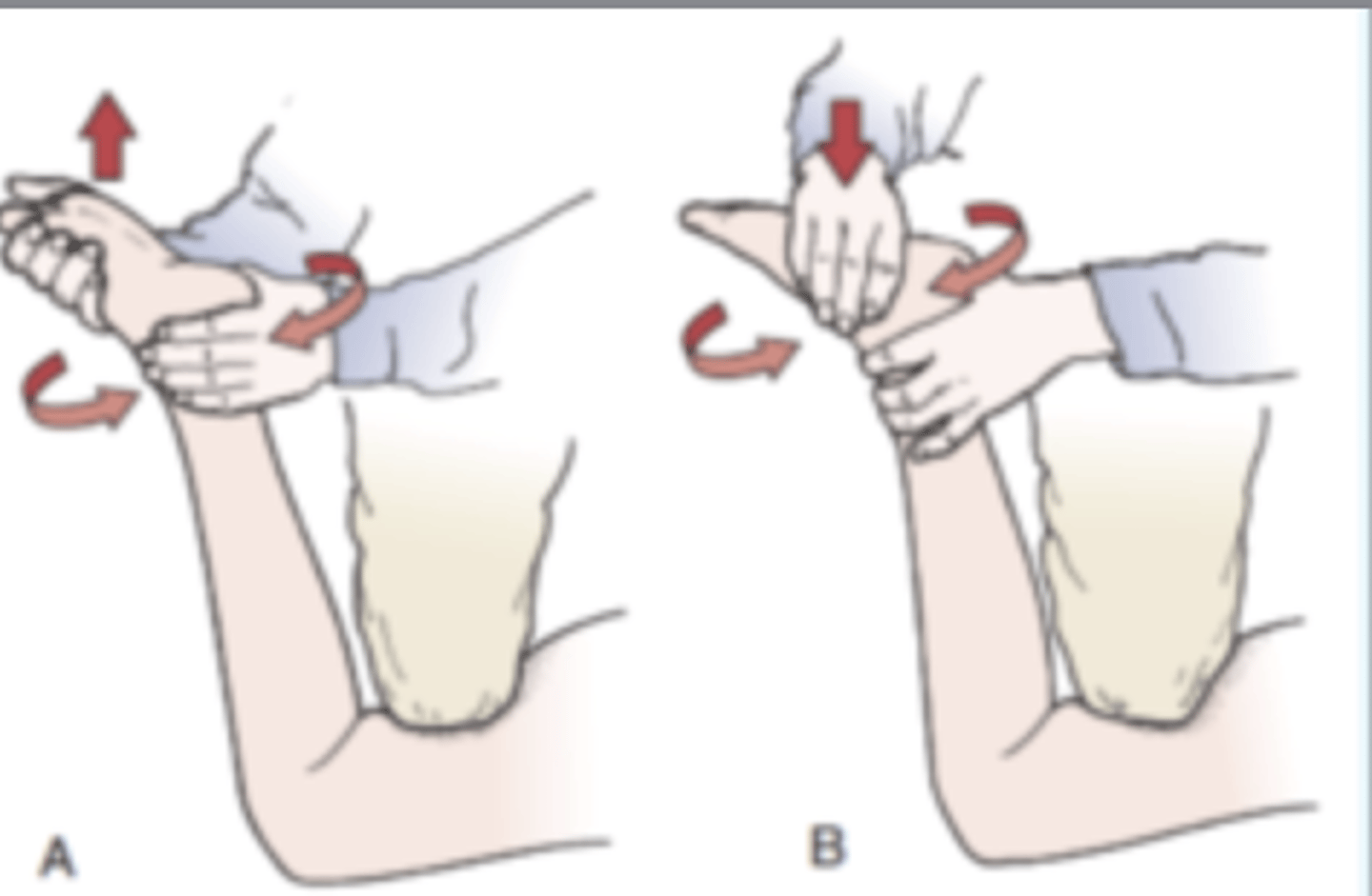 <p>- helps differentiate between meniscal tears and ligamentous lesion</p><p>Procedure:</p><p>- The patient lies in the prone position with the knee flexed to 90°. The patient's thigh is then anchored to the examining table with the examiner's knee. The examiner medially and laterally rotates the tibia, combined first with distraction, while noting any restriction, excessive movement, or discomfort. Then the process is repeated using compression instead of distraction</p><p>(+): If rotation plus distraction = ligamentous.</p><p>Rotation plus compression = meniscus injury.</p>