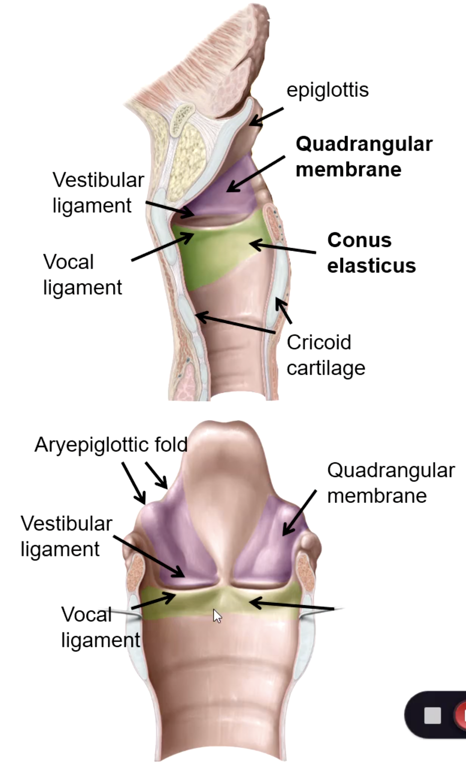 <p>conus elasticus</p>