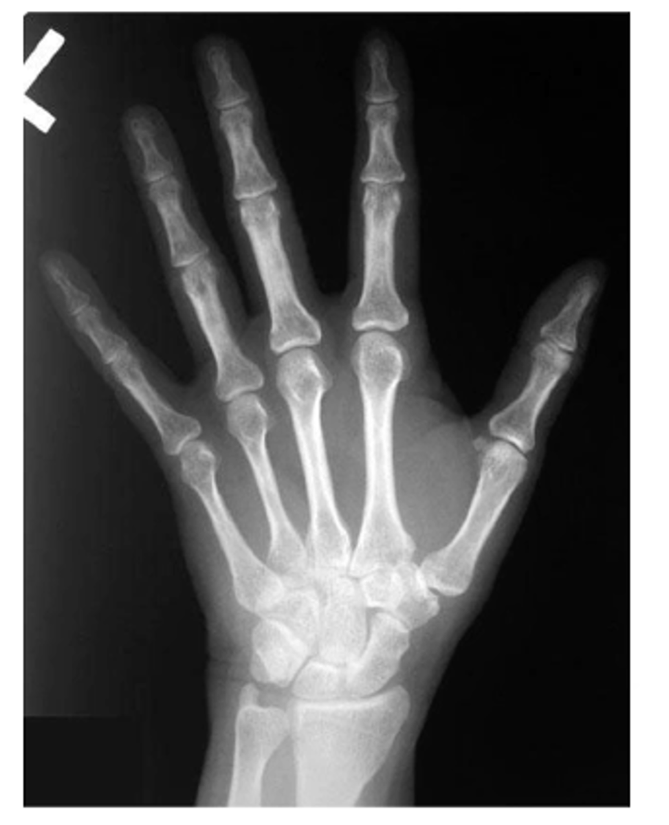 <p>State the type of view and structure being depicted.</p>