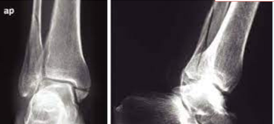 <p>TRMALEOLAR WEBER C</p>