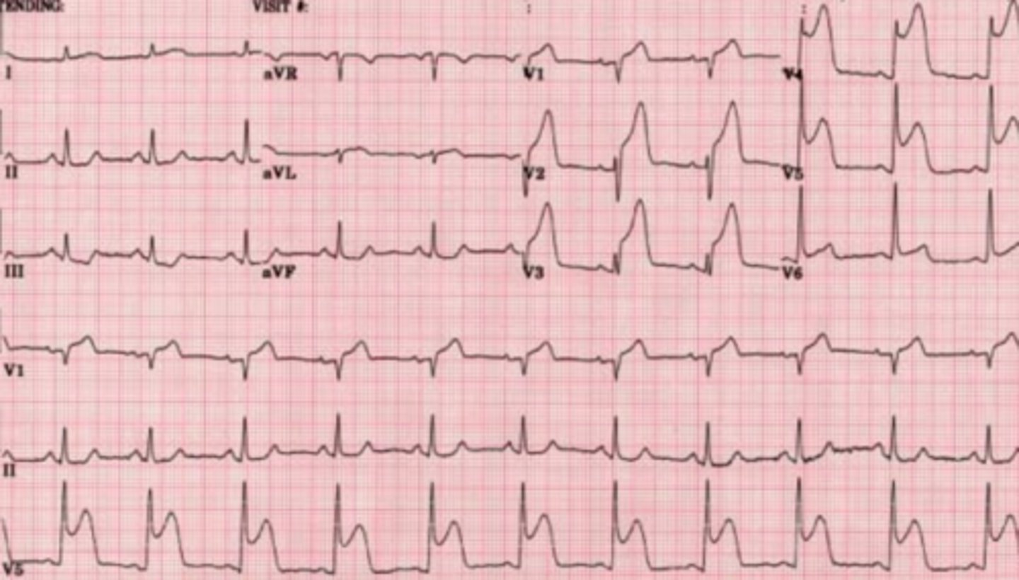 <p>What are the findings</p>