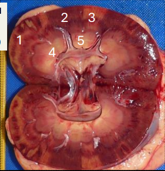 <p>What areas or the kidney, labelled as 1-5 are abnormal?</p>