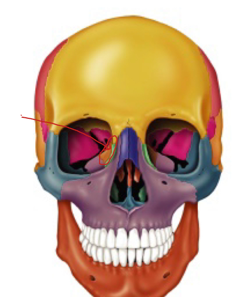 <p>What is the arrow pointing to? </p><p>(outer part of eye)</p>