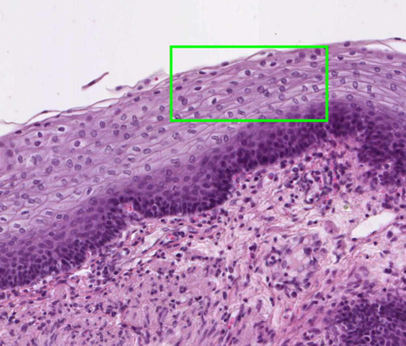 <p>Covers body and organ surfaces, both outside and inside</p>
