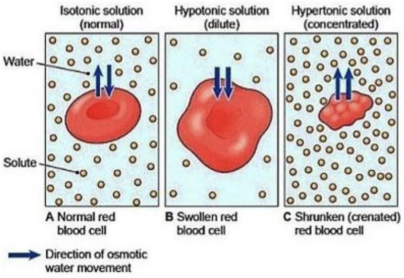 <p>→ relative [ ] of dissolved molecules (solute in solvent) on either side of a membrane (that is permeable only to the solution and NOT just the solutes dissolved in it)</p><ul><li><p><strong>Isotonic </strong>→ equilibrium solution</p><ul><li><p>Similar [ ] of solute and solvent around membrane</p></li></ul><p></p></li><li><p><strong>Hypotonic</strong> → diluted solution</p><ul><li><p>↑ [solute] inside membrane</p></li><li><p>Solvent will move in</p></li><li><p>Cells swell</p><p></p></li></ul></li><li><p><strong>Hypertonic</strong> → concentrated solution</p><ul><li><p>↑ [solute] outside membrane</p></li><li><p>Solvent will move out</p></li><li><p>Cell shrinks</p></li></ul></li></ul><p></p>