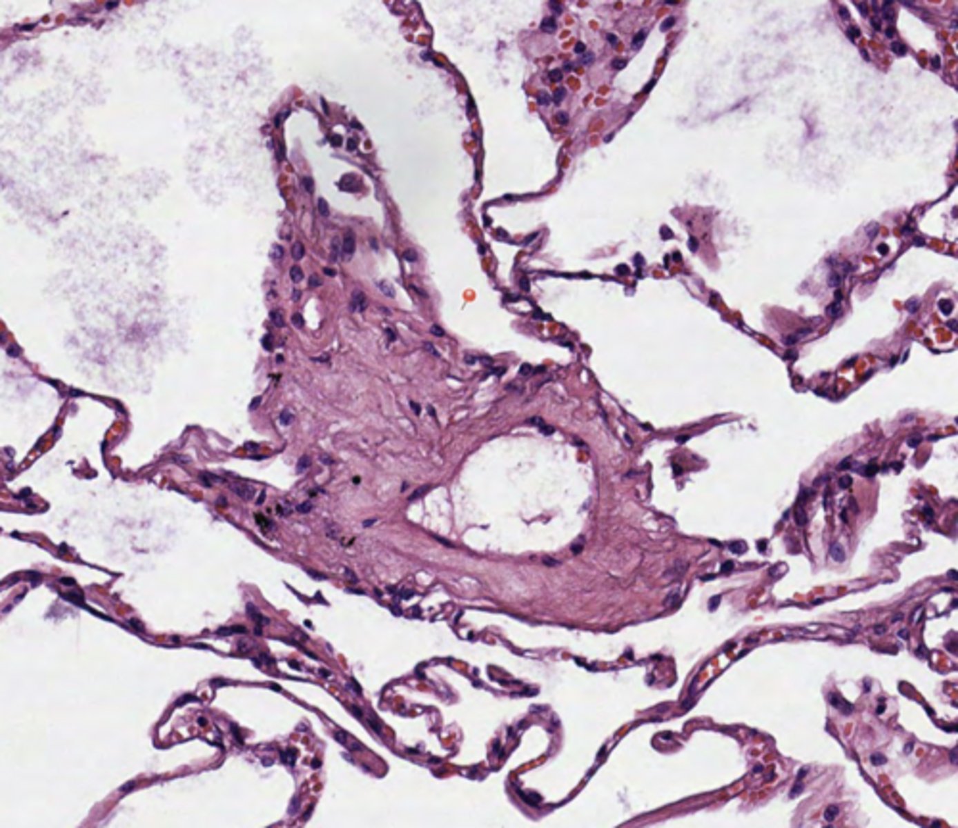 <p>Lung</p>