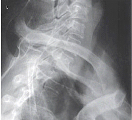 <p><span>Which projection of the vertebral column is depicted in the figure below?</span></p>