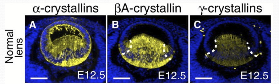 <p>Facilitates transparency, refraction of lens. Creates destructive interference of scattered light and prevents protein unfolding. Lower crystallin conc towards surface of lens. </p>