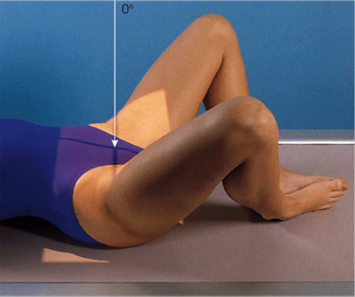 <p>frog leg → hips and knees flexed and hips externally rotated</p><p>commonly used in uro/gyn sx</p>