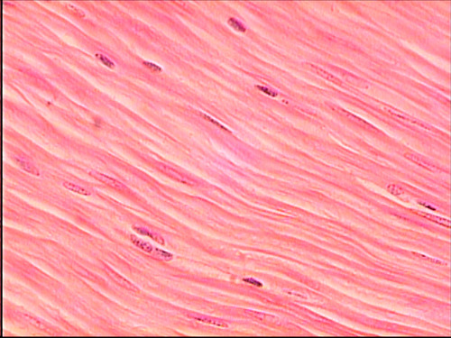 type of muscle tissue?
