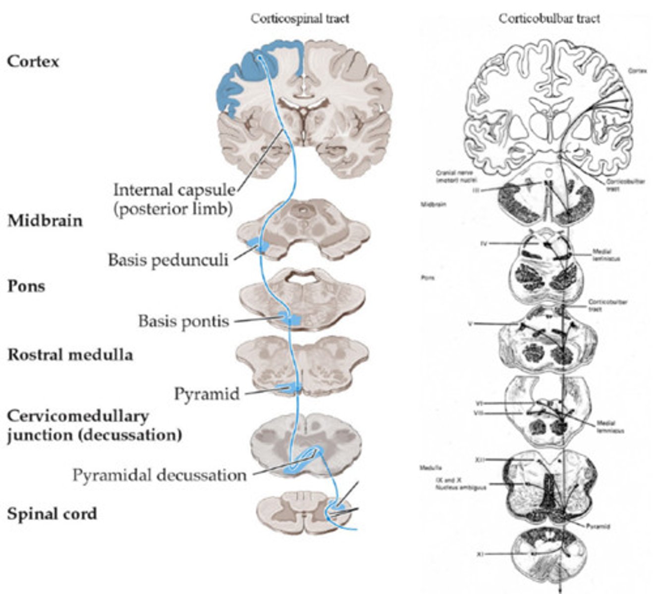 <p>Direct control of movements in head and neck</p><p>Synapse on brainstem nuclei</p><p>Damage = contralateral weakness of lower face</p>