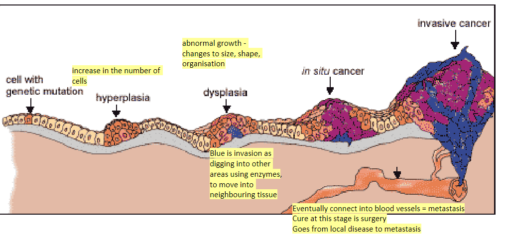 <ul><li><p>hyperplasia - increase in the number of cells</p></li><li><p>dysplasia - abnormal growth - changes to size, shape, organisation</p></li></ul><p></p>