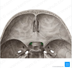 knowt flashcard image