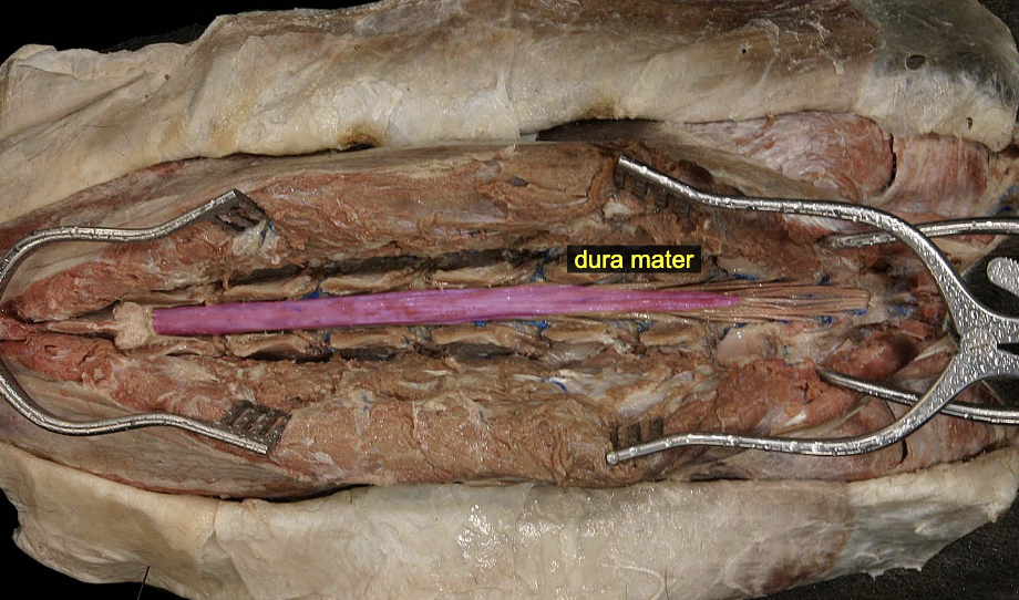 <p>Dura mater</p>