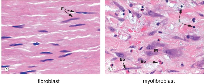 <ul><li><p>bv. bij wondgenezing &amp; bij andere reparatieprocessen na beschadiging &amp; defecten</p><p>→ toename van actinefilamenten in het cytoplasma van fibroblasten</p><p>=&gt; cellen krijgen contractiele eigenschappen</p></li></ul><p>= myofibroblasten</p><p></p>